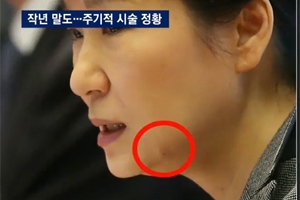 朴대통령, 세월호 당일 실리프팅 시술 가능성…“김영재 전문 분야”