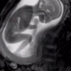 MRI로 담아낸 엄마 뱃속 태아의 모습