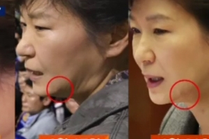 세월호 당일, 靑 의약품 장부에 ‘드레싱’…미용 시술 의미?