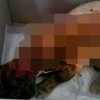 용인서 불에 탄 길고양이 발견…경찰 ‘동물학대 가능성’ 수사