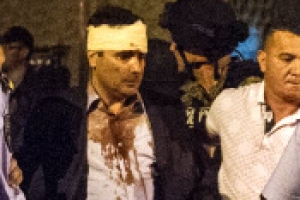 [포토] 시위대 공격받은 마케도니아 야당대표 피투성이