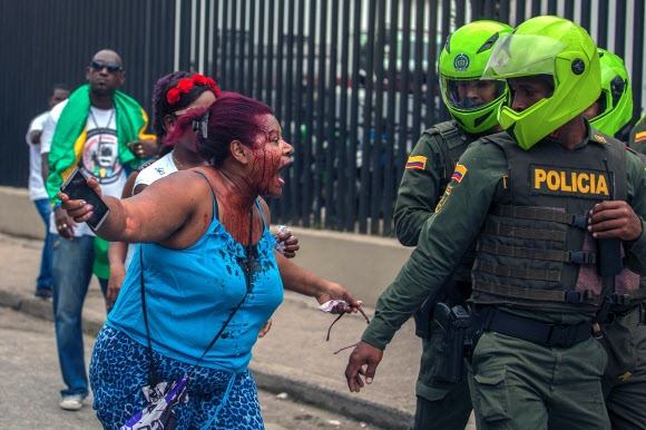 피를 흘리며 경찰을 향해 소리치는 콜롬비아 여성