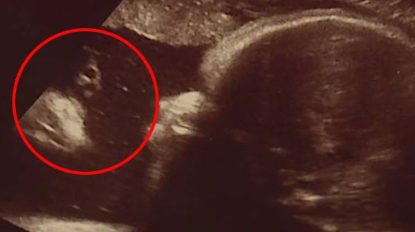 잭 스미스 페이스북