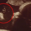 행운 불러온 태아 초음파 사진에 찍힌 예수(?)