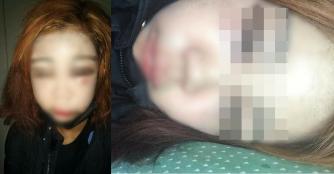 ‘인천 여중생 집단폭행’이라는 제목으로 페이스북에 공유된 사진. 실제로는 졸업을 앞둔 여고생으로 부모와 함께 경찰을 찾아 고소장을 냈다. 2018.1.7.  페이스북