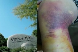 원산폭격에 방망이 폭행까지…“그래도 버터야 했습니다”