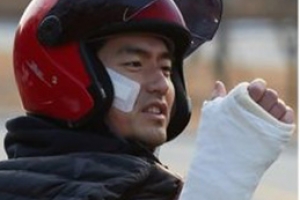 ‘리턴’ 이진욱, 상처투성이 얼굴+한쪽 팔에 깁스 ‘무슨 일?’