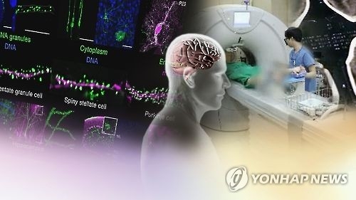 미세먼지가 자폐증 유발한다...연구결과 발표 [연합뉴스TV 제공] 연합뉴스