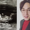 SG워너비 이석훈♥최선아, 결혼 2년 만에 부모됐다...“너무나 벅차다”