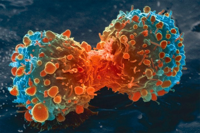 종양줄기세포는 암세포로 분화되기 전 단계의 씨앗세포로 재생과 분화능력이 강해 암을 만들고 전이 재발시키기도 한다. 미국 하버드대 줄기세포연구소 제공