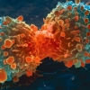 암 일으키는 씨앗 ‘종양줄기세포’ 찾아 없앤다