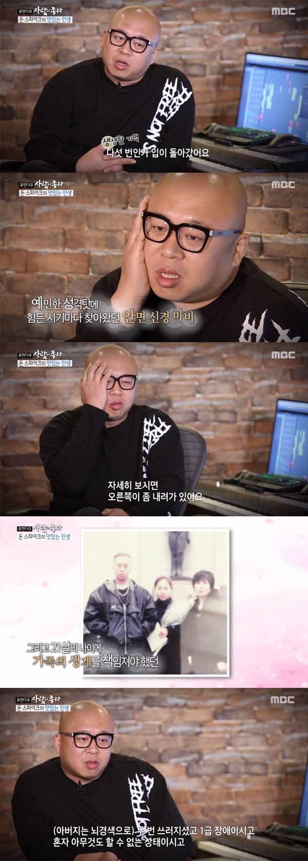 돈스파이크 안면마비