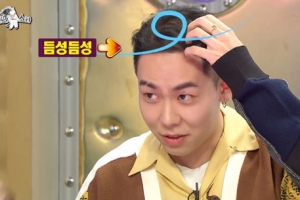 로꼬, 탈모 고백 “고3때부터 시작..가장 큰 이유는 스트레스”