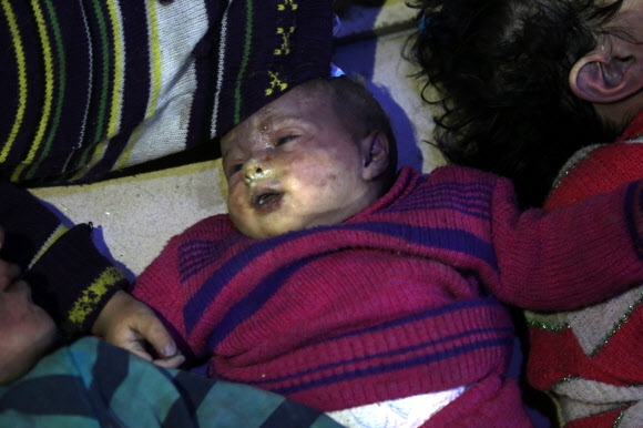 8일(현지시간) 시리아 동구타 두마 지역에서 화학무기 공격에 노출된 어린아이. EPA 연합뉴스