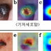 피부암 찾는 AI 전문의 능가하네