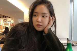 에이핑크 손나은, 발목 부상 “활동 그대로...격한 안무 등에서 배제”