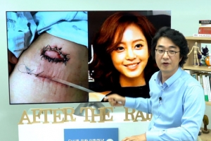 홍혜걸 “한예슬 지방종 의료사고 의문…치명적 흉터 남을 것”
