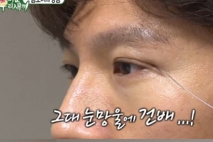 김종국 성형상담, 짙은 쌍커풀에 폭소 “너무 이상해”