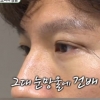 김종국 성형상담, 짙은 쌍커풀에 폭소 “너무 이상해”