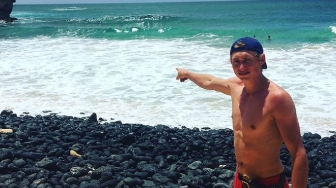 딜런 맥윌리엄스가 하와이 카우아이섬 해변에서 자신이 상어 공격을 받은 지점을 손으로 가리키고 있다.