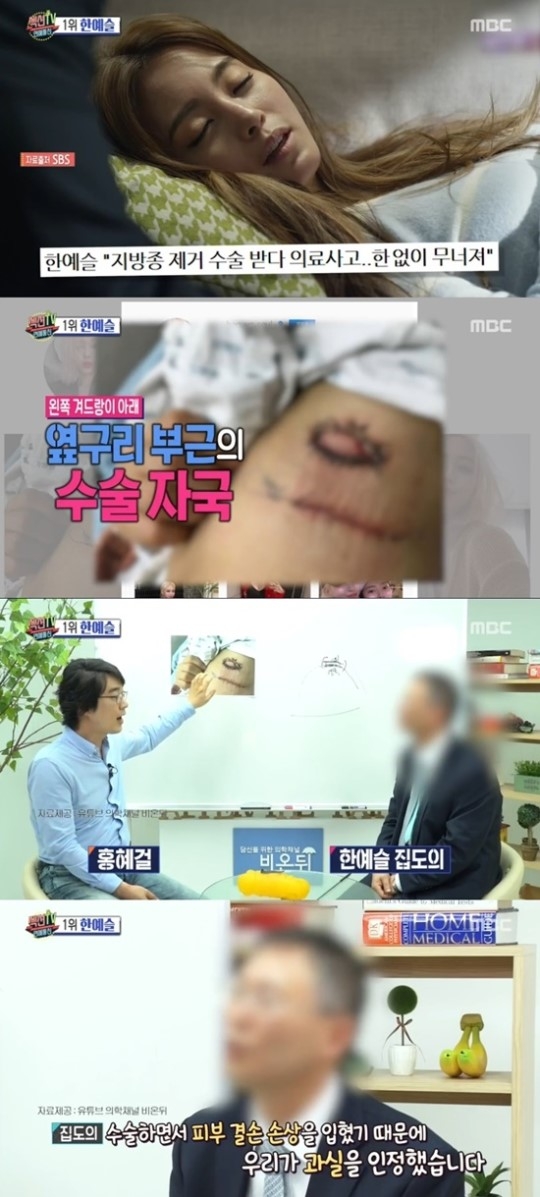 ‘섹션TV’ 한예슬 차병원 의료사고