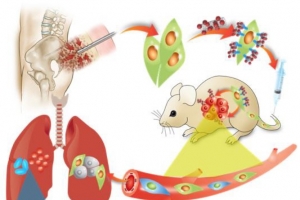 줄기세포 표면에 나노약물 결합한 폐암 치료 방법 개발