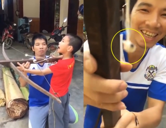 석궁 사용해 앞니 빼는 용감한 아빠와 아이(유튜브 영상 캡처)