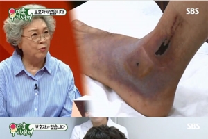 박수홍 입원 “클럽에서 놀다 떨어져...‘봉와직염’ 피부 이식해야 할지도”