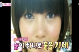 박나래 앞트임 복원 수술 고백 “베란다 확장한 느낌..찬바람 들어와”