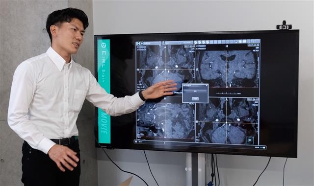 인공지능(AI) 활용 영상분석 기업 엘픽셀의 창업자이자 대표이사인 시마하라 유키가 지난 3일 도쿄대 혼고캠퍼스 내 연구실에서 뇌동맥류 판독 프로그램을 시연하고 있다. 　도쿄 손형준 기자 boltagoo@seoul.co.kr