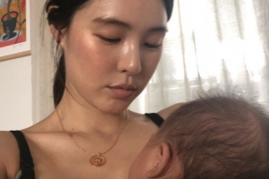 ‘둘째 득남’ 가희, 모유수유 고충 토로 “백반증 때문에 너무 힘들어”