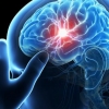 산소 부족으로 인한 뇌손상 치료물질 개발…뇌졸중 치료 가능성