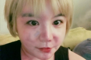 에이미 근황, 90kg까지 살 찌운 모습 포착 “같이 살 빼보자”