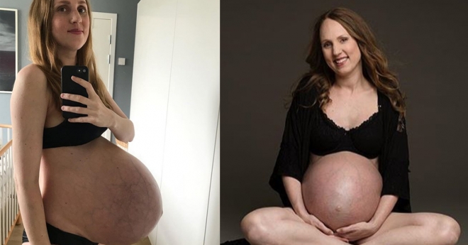 세쌍둥이를 임신한 모습을 공개한 여성.  사진=triplets_of_copenhagen/인스타그램