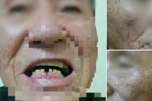 70대 경비원 때린 10대 “아빠가 변호사라고 안했다”