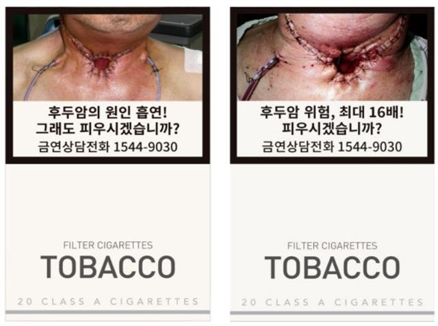 금연 효과를 높이기 위해 후두암에 대한 사실적인 사진과 구체적인 수치를 포함한 새 담뱃갑의 경고 그림과 문구(오른쪽). 2016년 12월 도입된 기존의 후두암 경고 그림과 문구(왼쪽).  보건복지부 제공