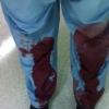 NRA “선이나 지키시지”에 의사들 피 묻은 수술복 보여주다
