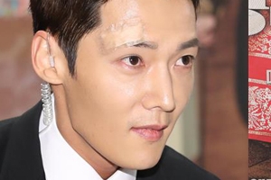 ‘황후의 품격’ 최진혁, 얼굴 부상에도 제작발표회 참석 ‘부상투혼’