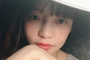 구하라, 근황 공개 ‘볼에 선명한 붉은 자국’ 눈길