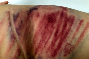 [포토] 태권도부 코치, 여중생 폭행