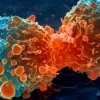 항암치료 방해하고 암 전이, 재발 시키는 암 유전자 발견