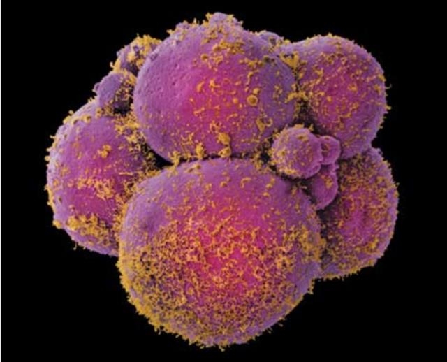 버그 석좌교수 8세포 단계에 있는 인간배아 세포를 전자현미경으로 촬영한 모습.  네이처 제공