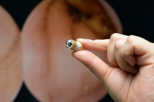 삼키기만 했을 뿐인데 위가 훤히 들여다보이네