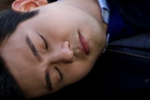 알베르 크로커스 증후군, 검색해도 나오지 않는 병명?