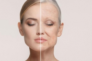 보톡스 없이도 주름진 세월을 피할 수 있다?