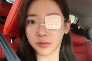 ‘김상혁♥’ 송다예, 결혼 앞두고 눈 부상 “안대 낀 신부”