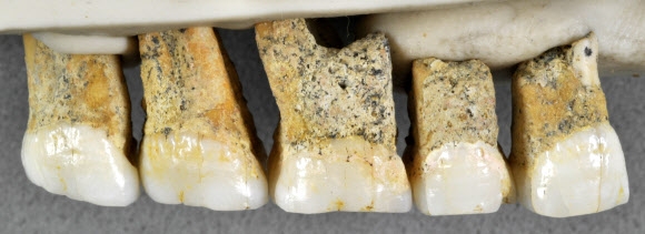 필리핀 루손섬 칼라오 동굴에서 발견된 호모 루조넨시스의 치아. 약 5만년 전에서 6만 7000여년전에 살았던 것으로 추정된다.  루손 AP 연합뉴스
