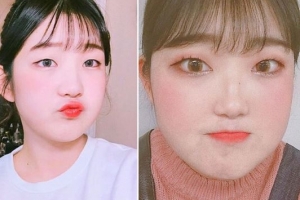 최진실 딸 근황, 루푸스병 ‘부어도 자신감 넘치는 얼굴’