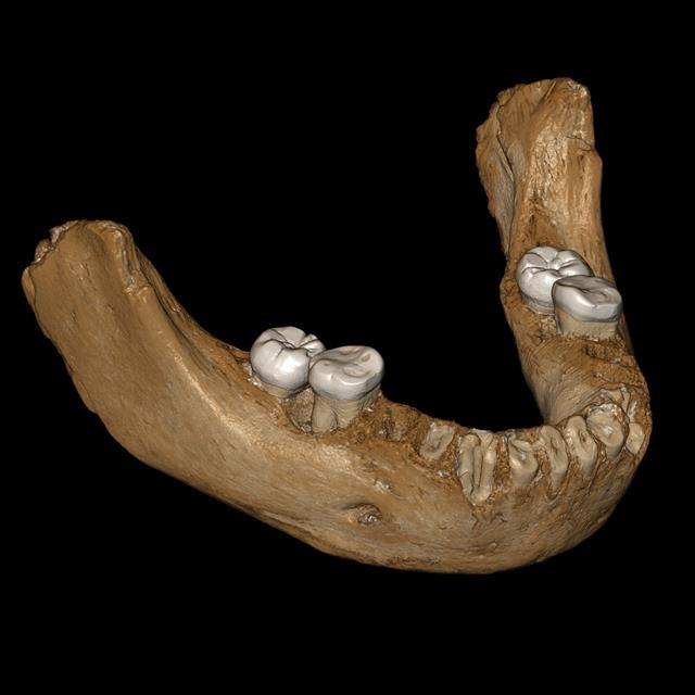 이번에 발굴된 고산 지역 거주 데니소바인의 아래턱뼈를 3차원으로 재구성해 만든 이미지. 턱뼈 일부가 잘 보존돼 있어서 완전한 아래턱뼈를 컴퓨터 시뮬레이션으로 복원할 수 있었다.  독일 막스플랑크 진화인류학연구소·중국 란저우대·네이처 제공