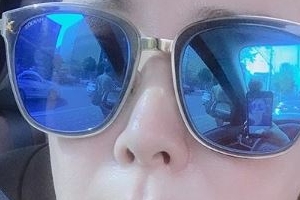 이상아, 입술 필러 부작용 고백 “도저히 안되겠다며..”